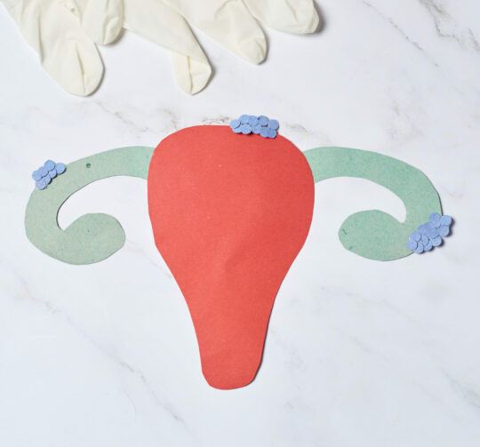 Female uterus with endometriosis, female wellness care concept